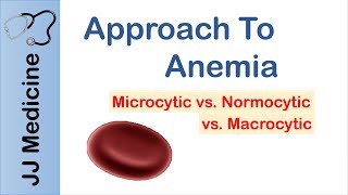 Anemia  Microcytic vs Normocytic vs Macrocytic [upl. by Brit368]