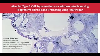 10102024  Alveolar Type 2 Cell Rejuvenation as a Window into Reversing Progressive Fibrosis [upl. by Thurlough6]