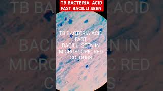 Acid fast bacilli T B bacteriashortvideobmlt dmlt medical mlt mbbs [upl. by Earas]