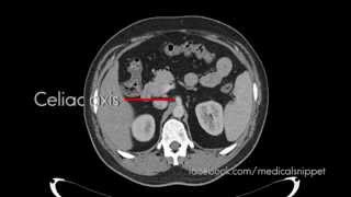 Branches of Celiac Axis [upl. by Rodrique971]