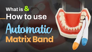 What is amp How to use Automatic Matrix Band  SuperEndo [upl. by Enomas802]