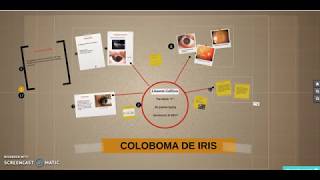 Coloboma de iris por Lissette Gallino [upl. by Nazarius]