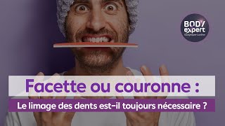 SOINS DENTAIRES  🦷 Facettecouronne  Le limage des dents estil toujours nécessaire   BODYEXPERT [upl. by Layap]