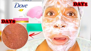 I USED PINK DOVE SOAP ON MY FACE EVERYDAY FOR 8 DAYS [upl. by Atronna]