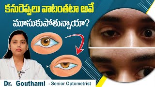 Ptosis Causes amp Treatment  Droopy Eyelid  కన్ను రెప్పలు వాలిపోతున్నాయా  Best Vision Eye Hospital [upl. by Cirdahc]