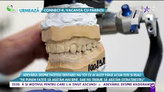 Adevarul despre fatete dentare [upl. by Eiramait]