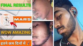 BEARD GROWTH  wow amazing results □ इतने कम दिनों में दाढ़ी आ गई  final results from mars by ghc [upl. by Aicelef]