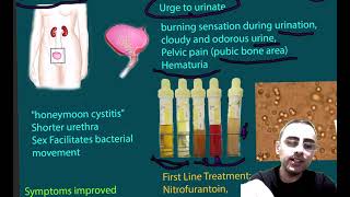 Urinary Tract Infections UTIs Symptoms Causes Treatment [upl. by Llecrup]