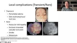 Lecture Innovations and Advances in Retinoblastoma Management [upl. by Anne]