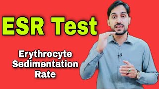 ESR Test  Erythrocyte Sedimentation Rate  High ESR Causes [upl. by Durham416]