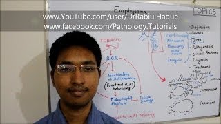 Emphysema  Definition Pathogenesis Clinical Features Diagnosis amp Treatment HD [upl. by Aggappera]