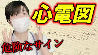 危険な心電図見逃していませんか？誰でもわかる心電図の読み方！【初心者編🔰】 [upl. by Neyu375]