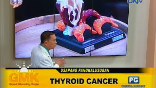 Thyroid Cancer [upl. by Fisuoy542]