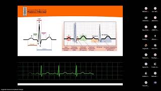 fisiopatología  CARDIOLOGÍA II arritmias cardiacas [upl. by Alexina]