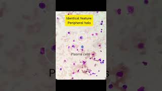 Plasma cells and Megakaryoblast identification💡👍  Cells identification  MLS Masterclass👩‍🎓👨‍🎓 [upl. by Perdita]