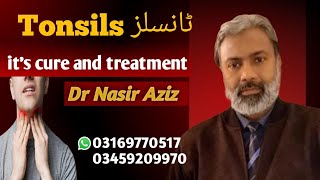 Tonsillitis and its treatment Homeopathic DrNasir Aziz Consult us before operation [upl. by Yroffej]