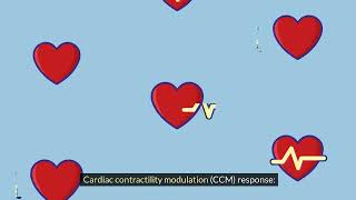 How to measure Chronotropic incompetence in a patient with unicameral leadless pacemaker [upl. by Nilla]