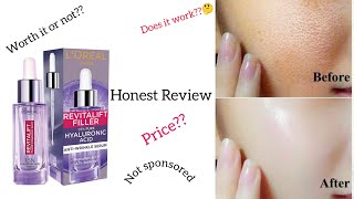 Hyaluronic acid serum review  LOréal hyaluronic acid serum  Transform Your Skincare Routine💫 [upl. by Nolly]