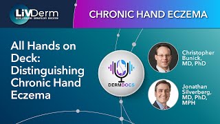 Chronic Hand Eczema All Hands on Deck [upl. by Ferrel165]