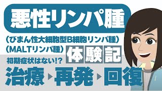 【悪性リンパ腫（MALTリンパ腫・びまん性大細胞型B細胞リンパ腫）】自覚症状はなかった…！？ [upl. by Pedro800]