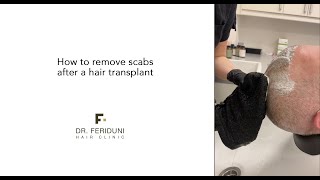 How to remove scabs after a hair transplant [upl. by Ludvig]