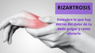 Rizartrosis Descubre lo que hay detrás del dolor en tu dedo pulgar y cómo aliviarlo [upl. by Edee]