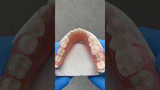 Lower TCS Unbreakable FiberFlex Partial EnvisiontecMain tcsdentalinc envisiontectcsdentalinc [upl. by Boylston]