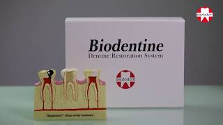 Biodentine mixing instructions [upl. by Devlin397]