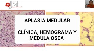 APLASIA MEDULAR APRENDIZAJE BASADO EN CASO CLÍNICOmedicina hematologia [upl. by Enuahs]