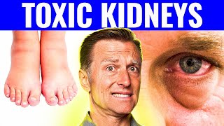 7 Warning Signs That Your Kidneys Are Toxic [upl. by Roderica227]