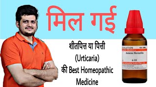 1 Best Homeopathic Medicine for Urticaria  हमेशा के लिए शीतपित्त या पित्ती का अंत सिर्फ एक दवा से [upl. by Reitman]