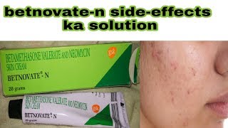 betnovate n cream ke sideeffects ka solution  how to use betnovate n cream  hindi [upl. by Auqeenahs]