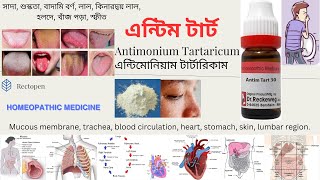 08 Antimonium Tartaricum l এন্টিম টার্ট l মেটেরিয়া মেডিকা l Materia Medical Learn Antim Tart easily [upl. by Gurevich]