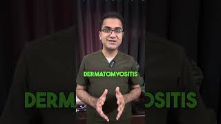 Prodoc Tip 47 Dermatomyositis and Importance of Malignancy Screening USMLE NEETPG [upl. by Elladine]