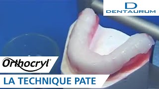 Orthocryl®  gouttière occlusale réalisée selon la technique pâte appareil dentaire [upl. by Simonsen210]