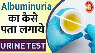 Causes of Albuminuria  Proteinuria Treatment in Ayurveda  Albumin Test  Kidney Problem [upl. by Aitsirhc]