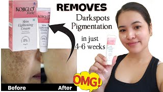 Cream for DARKSPOTS amp PIGMENTATION  Kojiglo Forte  Details in description 👇 [upl. by Nic816]