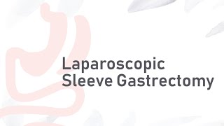 Laparoscopic Sleeve Gastrectomy  GampL Surgical Clinic [upl. by Dorotea242]