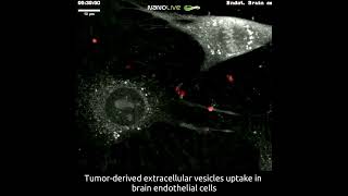 Tumorderived extracellular vesicles uptake in mouse brain endothelial cells [upl. by Gudren326]