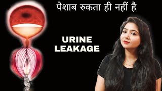 पेशाब रुकता ही नहीं है  URINE LEAKAGE IN FEMALE [upl. by Stacee596]