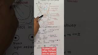 Pupillary light reflex Pathway and its defectviral trending [upl. by Roselba]