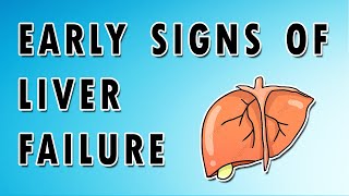 Symptoms of Liver Failure [upl. by Ahseia781]