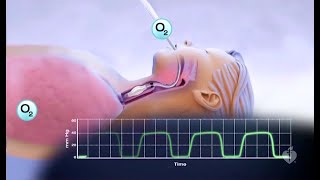 Capnography Made Easy [upl. by Macomber]