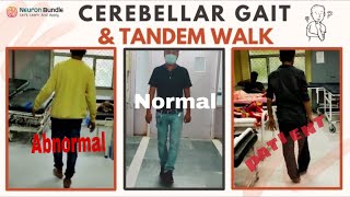 Cerebellar Ataxia Gait Abnormal TandemWalk neurology widebasegait tandemgait meded [upl. by Kcirdlek]