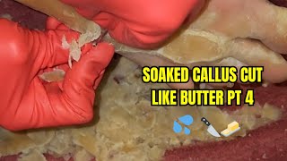 SOAKED CALLUS CUT LIKE BUTTER PT 4 [upl. by Madid]