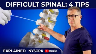 What to do when the needle encounters the bone during spinal or lumbar puncture [upl. by Olive735]