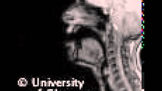 MRI voiced labiodental fricative [upl. by Lilla136]