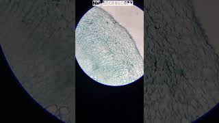 Xylem cells under microscope🔬shorts youtube [upl. by Carlie]