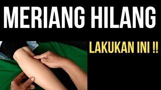 cara menyembuhkan rasa meriang fludemam dengan pijat refleksi [upl. by Tove]