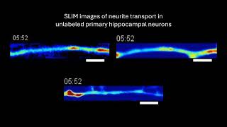 VideoOfTheDay Timelapse imaging and measurement of mass transport in neurites [upl. by Allbee]